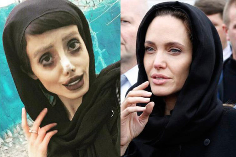 Teen undergoes 50 surgeries to look like Angelina Jolie