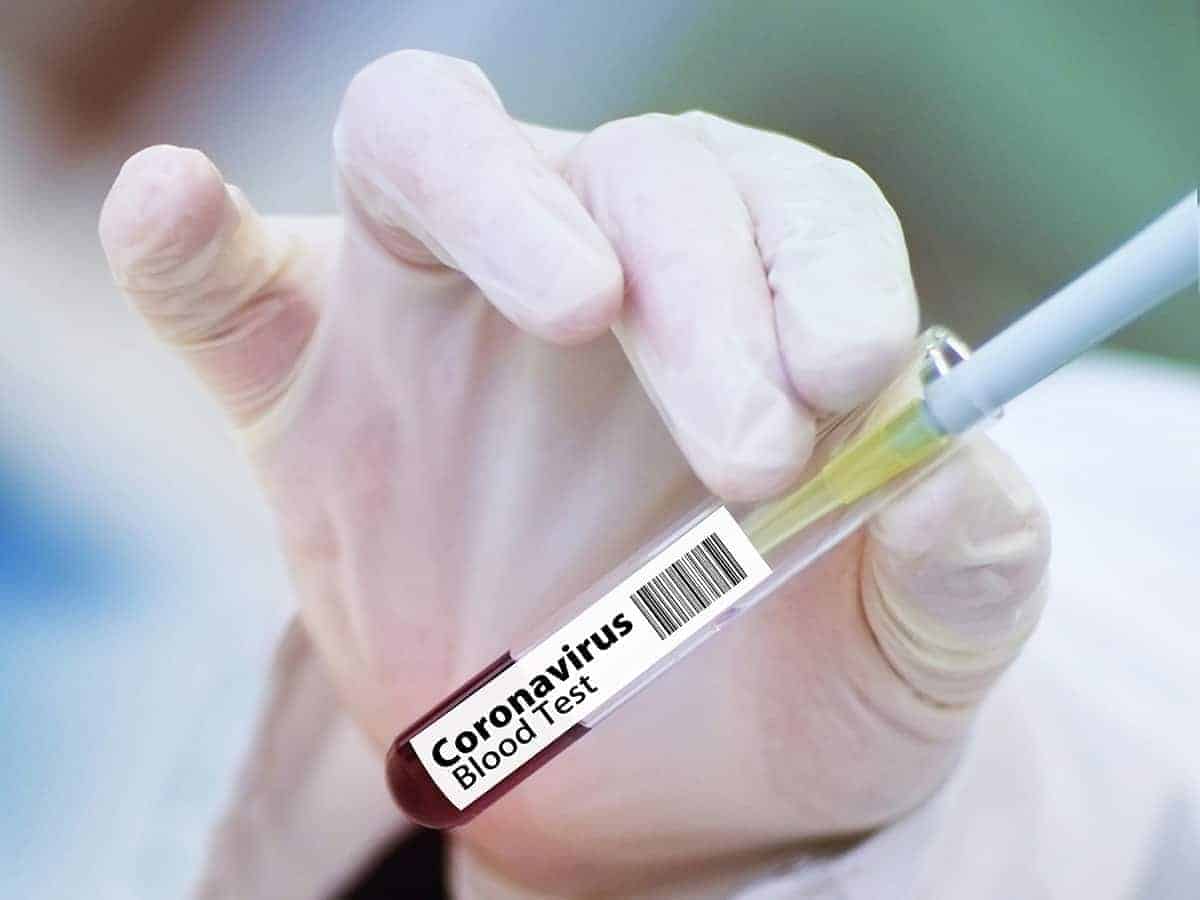 Coronavirus cases in US