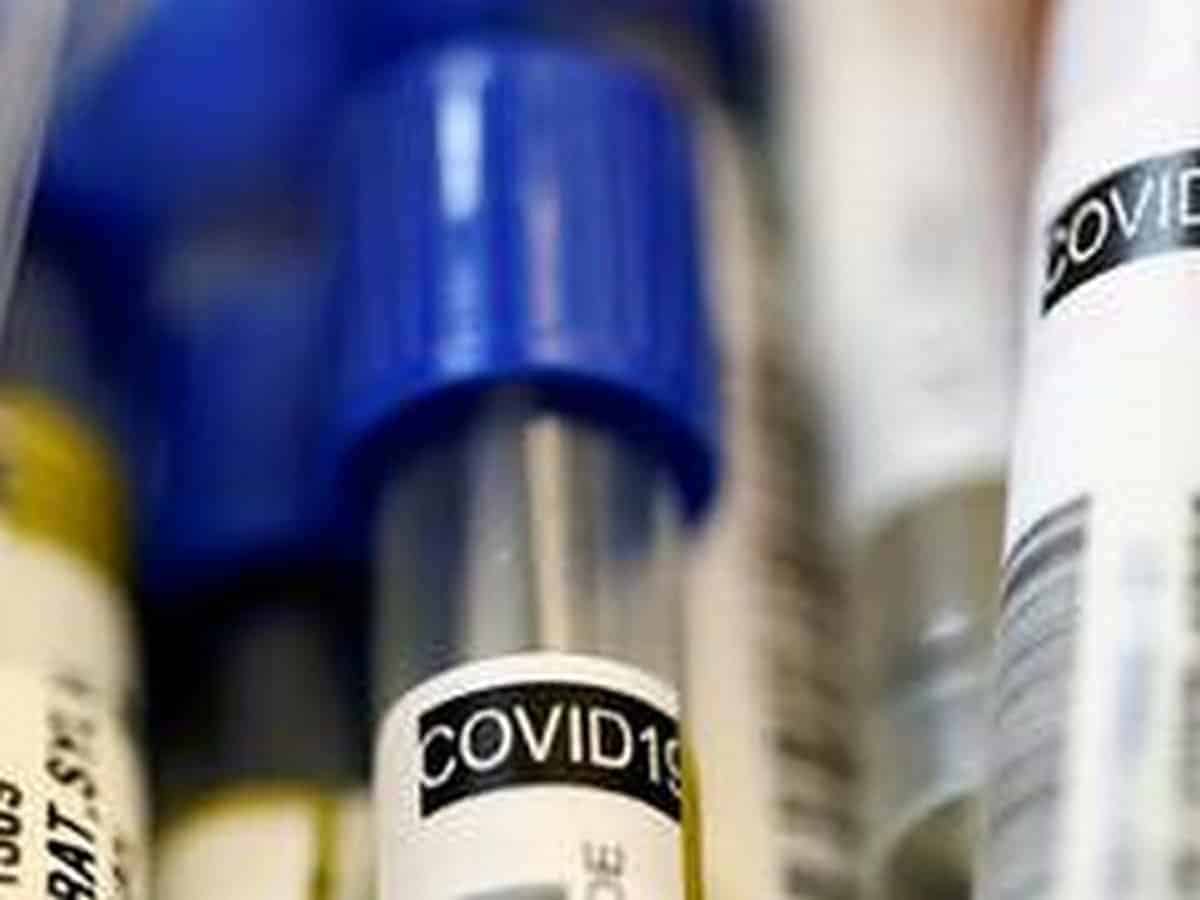 Coronavirus test in Hyderabad