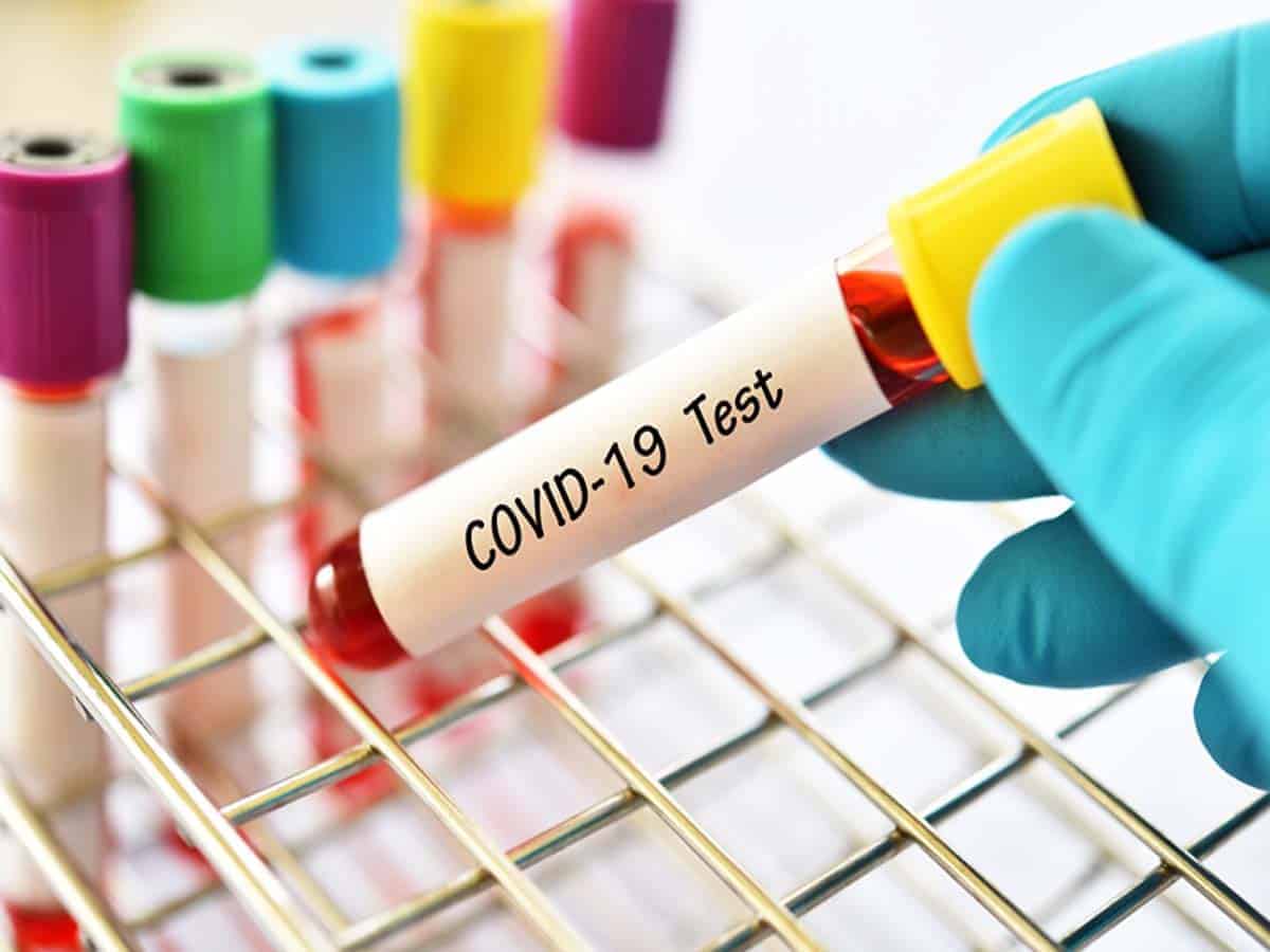 Hyderabad: CCMB to validate COVID-19 testing reagents and kits