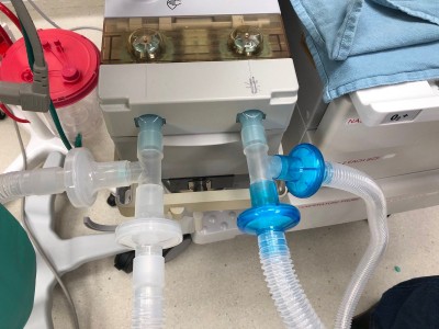 B'luru hospital to test indigenous non-invasive ventilator