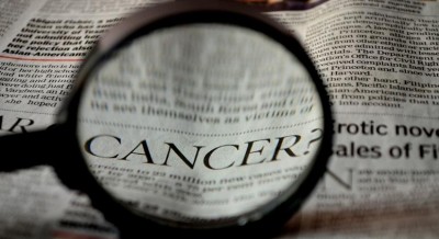 Cancer treatment may accelerate ageing process in young patients