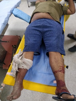 3 criminals injured in 2 encounters in Delhi