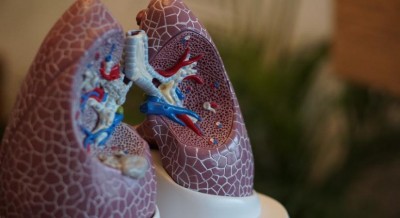 AstraZeneca, Qure.ai to bring AI solutions to detect lung cancer
