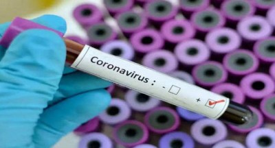 UK returnee tests Covid positive in Odisha, hospitalised