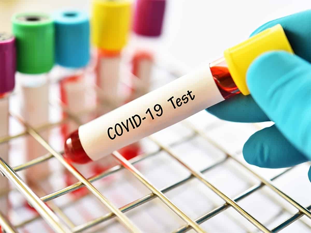 India adds 67,208 fresh COVID-19 cases in single day