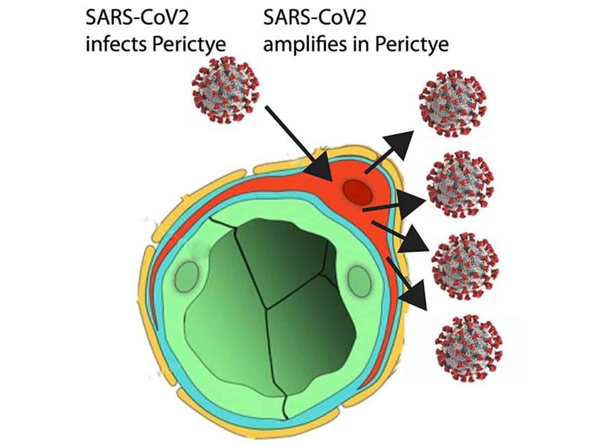 3D 'assembloid' shows how SARS-CoV-2 infects brain cells