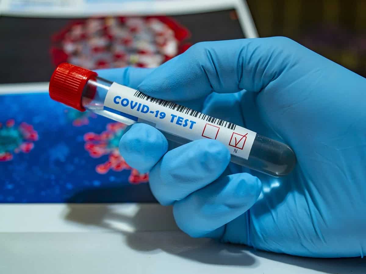India reports 15,786 COVID-19 infections in last 24 hours