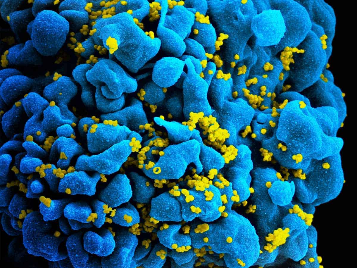 Scientists identify 2nd HIV patient whose body rid itself of virus